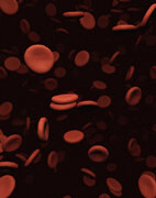 Blutarmut betrifft die roten Blutkörperchen
