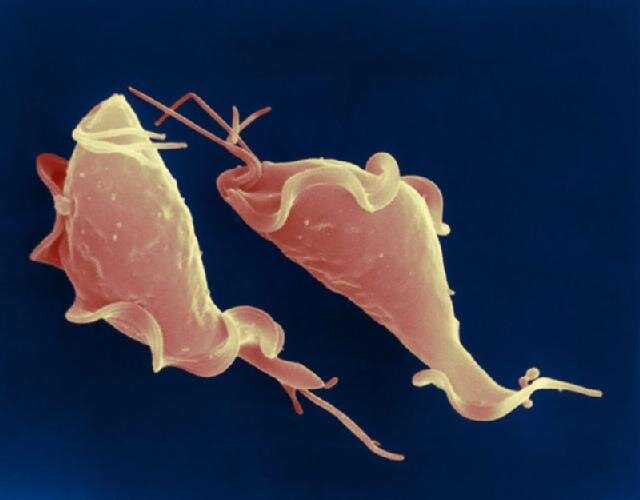 TrichomonadenInfektion Ursachen Apotheken Umschau