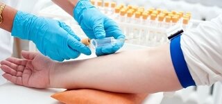 Eiweiss Elektrophorese Aufteilung Der Proteine Apotheken Umschau