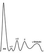 Beispiel für das Kurvendiagramm einer Eiweiß-Elektrophorese: Die Eiweiße wandern von rechts nach links, die Albumine sind also am weitesten gekommen, die &#x3d2;-Globuline am wenigsten weit