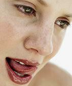 Die Zunge brennt, der Mund ist trocken: Dahinter könnte eine Schleimhautentzündung stecken