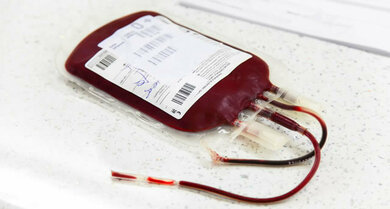 Besteht eine Blutarmut sind häufig Bluttransfusionen nötig