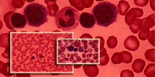 Rote Blutkörperchen unter dem Mikroskop