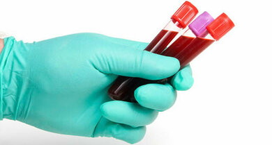 Auch Blutuntersuchungen gehören zur Diagnostik