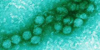 Elektronenmikroskop Aufnahme vom West-Nil-Virus