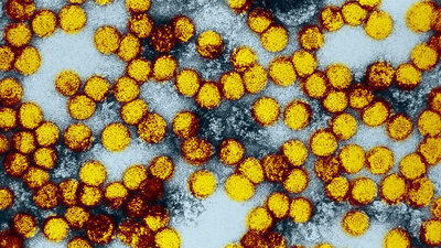 Das Gelbfieber-Virus unter dem Mikroskop (im Bild gelb eingefärbt)