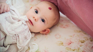 Hinter einem roten Fleck kann ein Blutschwämmchen - ein infantiles Hämangiom - stecken. Es betrifft vor allem Babys. Meistens ist es harmlos.