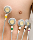 Bei der Brustwandableitung werden sechs Elektroden nach einem Schema platziert