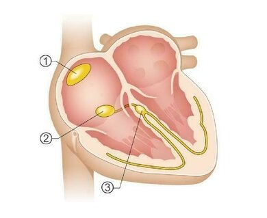 Der Sinuskonten (1) in den Vorhöfen, der AV-Knoten (2), der die Erregung über spezielle Bahnen (3) in die Herzkammern weiterleitet