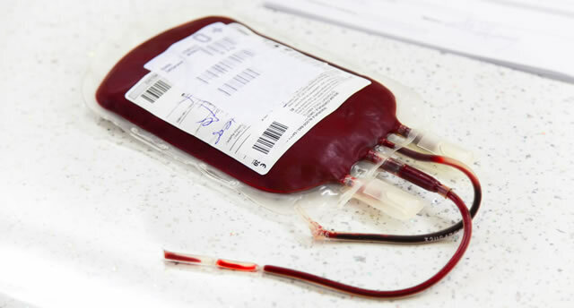 Bluttransfusion erklärt: Gründe, Ablauf und Risiken | Apotheken-Umschau