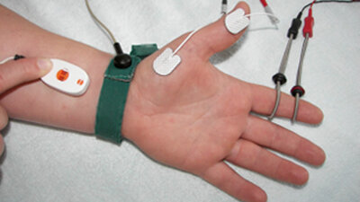 Elektroneurografie: Elektroden an der Haut