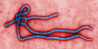 Das Ebolavirus, Erreger des Ebola-Fiebers.