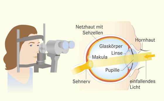 Gruner Star Vorsorge Gezerre Am Sehnerv Apotheken Umschau