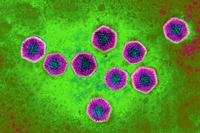 Gesund Werden Ohne Antibiotikum Apotheken Umschau