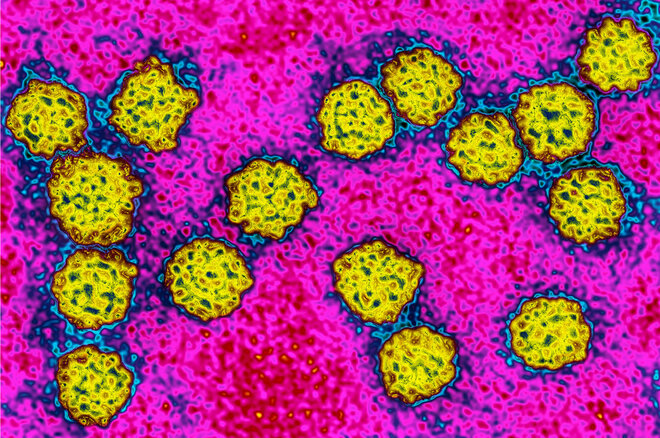 Gesund Werden Ohne Antibiotikum Apotheken Umschau