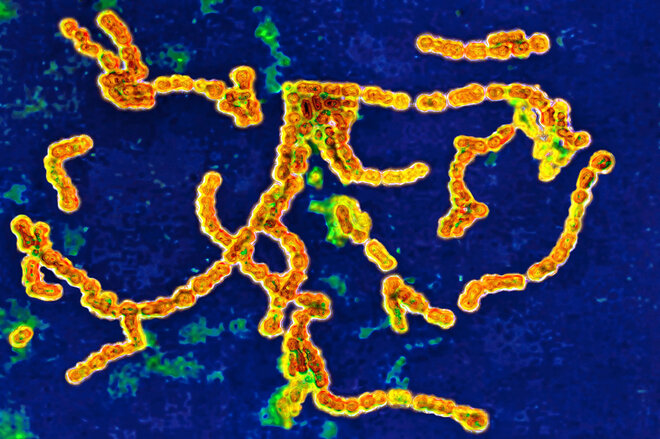 Gesund Werden Ohne Antibiotikum Apotheken Umschau