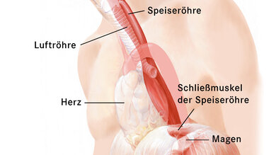 Das Bild zeigt den Verlauf der Speiseröhre