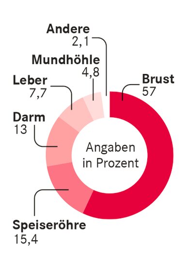 Risiko Alkohol: Krebsfälle bei Frauen, die auf Alkohol zurückzuführen sind