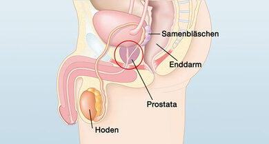 Das Bild zeigt: die Lage der Prostata.