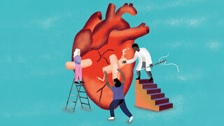 Am „gebrochenen Herzen“ ist etwas dran: Stress kann zum Broken-Heart-Syndrom führen.