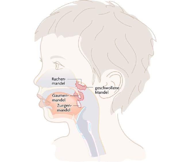 Schwellung Am Hals Ursachen Geschwollene Lymphknoten Speicheldrusen Apotheken Umschau