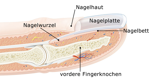 Nagelbettentzundung Symptome Und Behandlung Apotheken Umschau