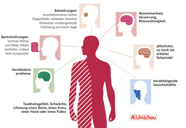 Gesichtslähmung – Diagnose: Wie Der Arzt Vorgeht | Apotheken Umschau