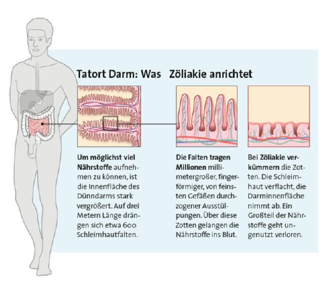 Schematische Darstellung vom Darm
